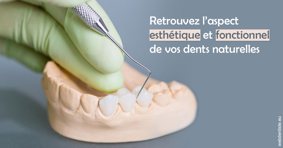 https://dr-nahon-jacques.chirurgiens-dentistes.fr/Restaurations dentaires 1