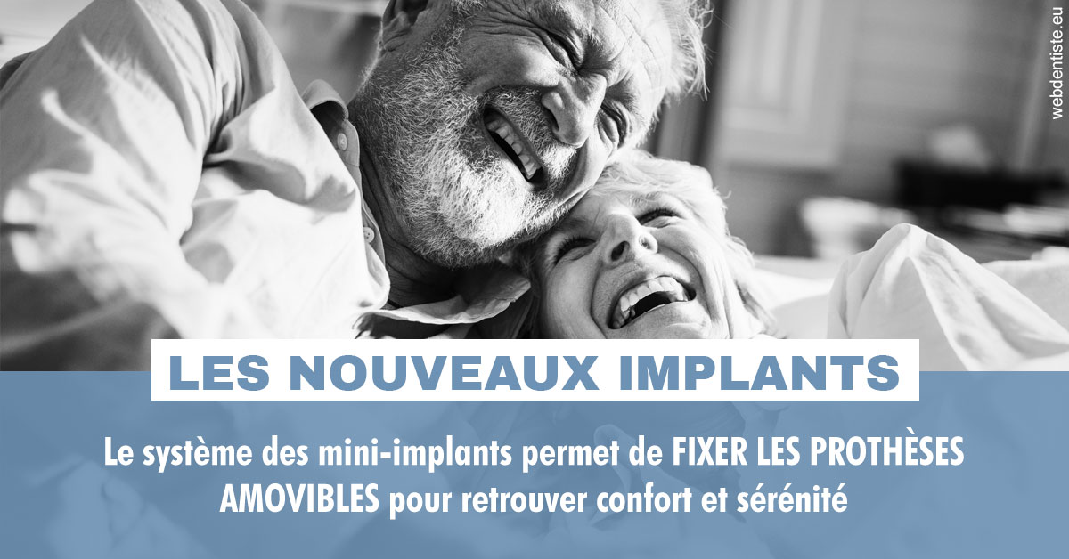https://dr-nahon-jacques.chirurgiens-dentistes.fr/Les nouveaux implants 2