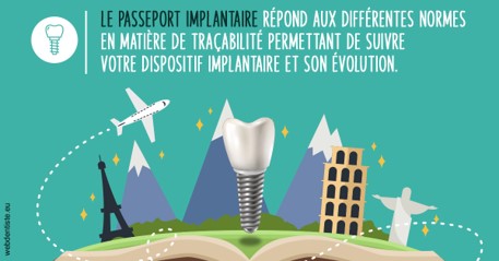 https://dr-nahon-jacques.chirurgiens-dentistes.fr/Le passeport implantaire