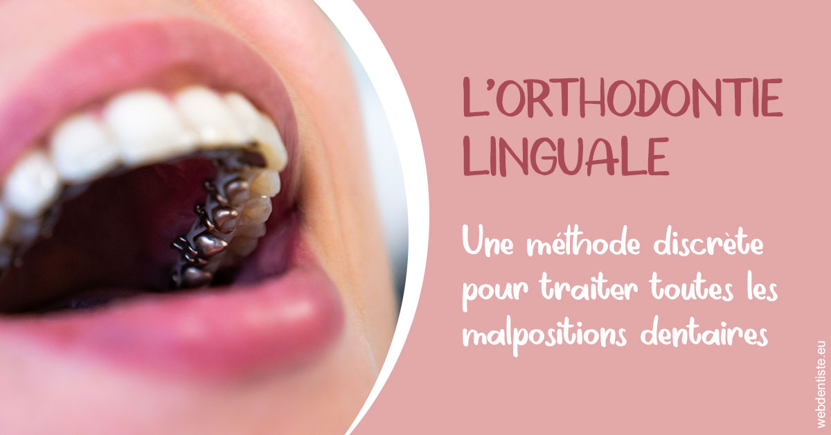 https://dr-nahon-jacques.chirurgiens-dentistes.fr/L'orthodontie linguale 2