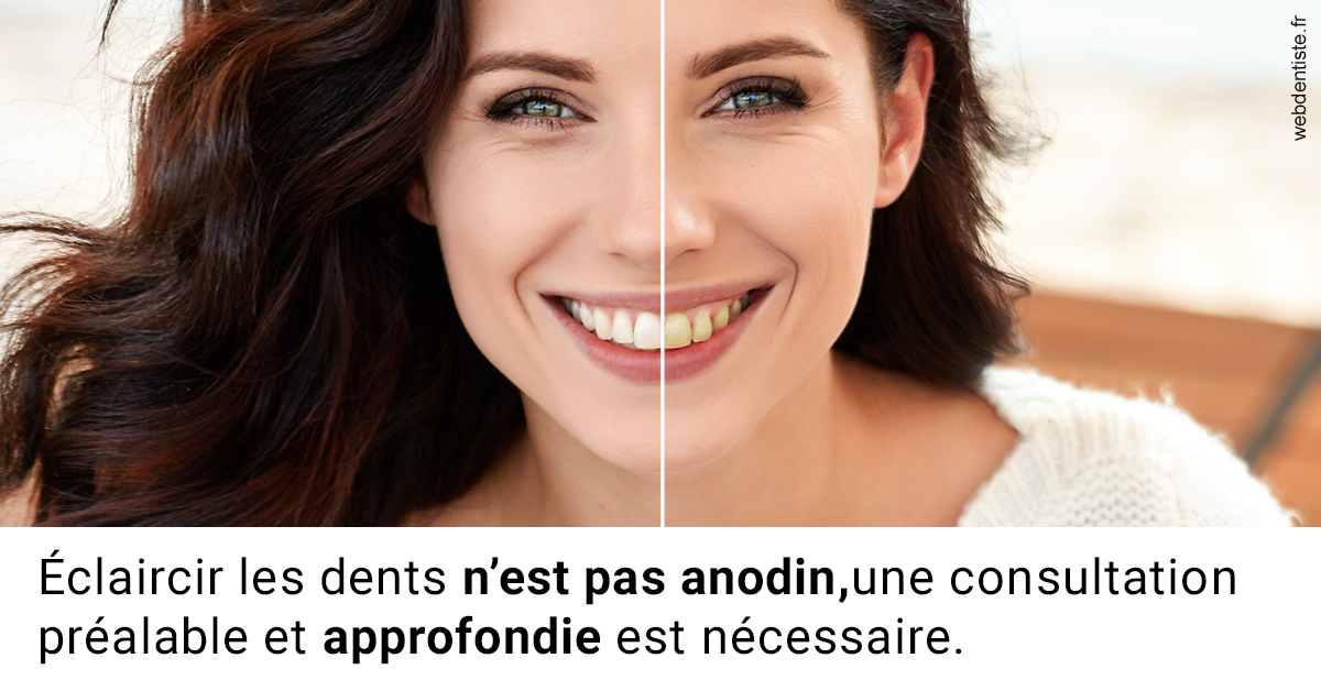 https://dr-nahon-jacques.chirurgiens-dentistes.fr/Le blanchiment 2