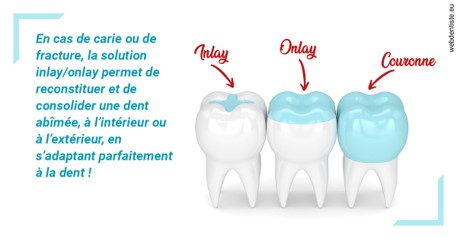 https://dr-nahon-jacques.chirurgiens-dentistes.fr/L'INLAY ou l'ONLAY