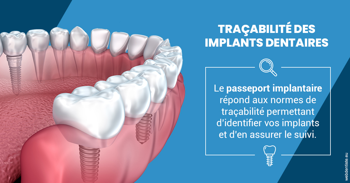 https://dr-nahon-jacques.chirurgiens-dentistes.fr/T2 2023 - Traçabilité des implants 1