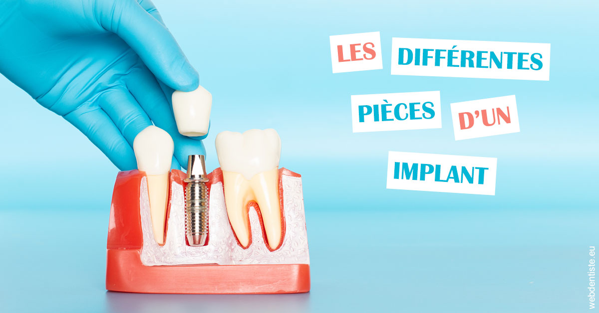 https://dr-nahon-jacques.chirurgiens-dentistes.fr/Les différentes pièces d’un implant 2