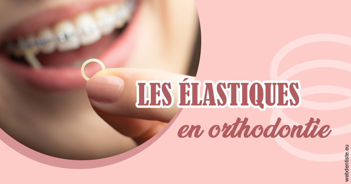 https://dr-nahon-jacques.chirurgiens-dentistes.fr/Elastiques orthodontie 1