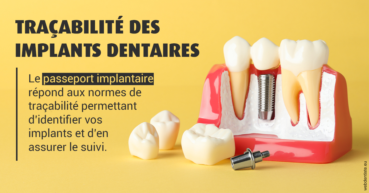 https://dr-nahon-jacques.chirurgiens-dentistes.fr/T2 2023 - Traçabilité des implants 2