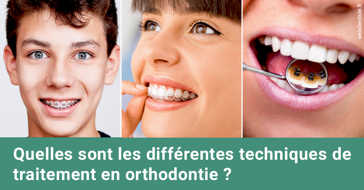 https://dr-nahon-jacques.chirurgiens-dentistes.fr/Les différentes techniques de traitement 2