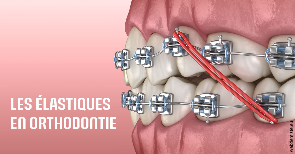 https://dr-nahon-jacques.chirurgiens-dentistes.fr/Elastiques orthodontie 2